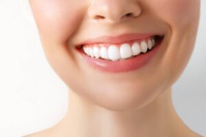 featured image for can veneers improve a gummy smile
