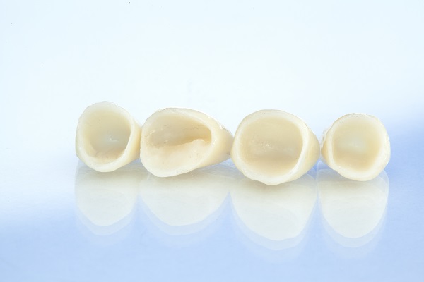image of dental crowns