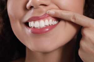 woman showing off gum health and healthy gums