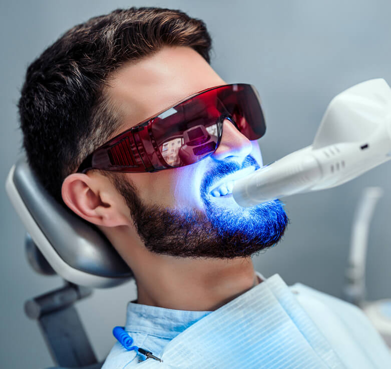 image of Close up view of man undergoing laser tooth whitening treatment to remove stains and discoloration.